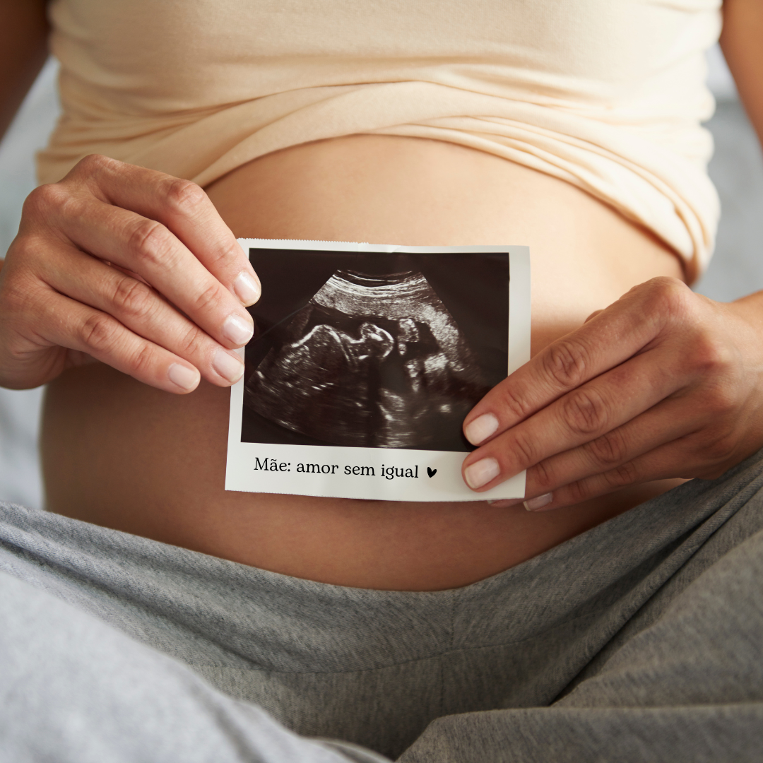 Fisioterapia para Gestantes